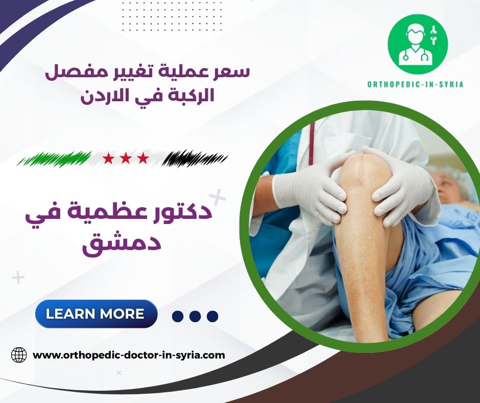 سعر عملية تغيير مفصل الركبة في الاردن