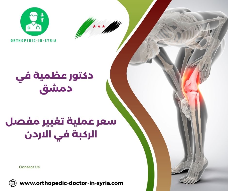 سعر عملية تغيير مفصل الركبة في لبنان سعر عملية تغيير مفصل الركبة في لبنان