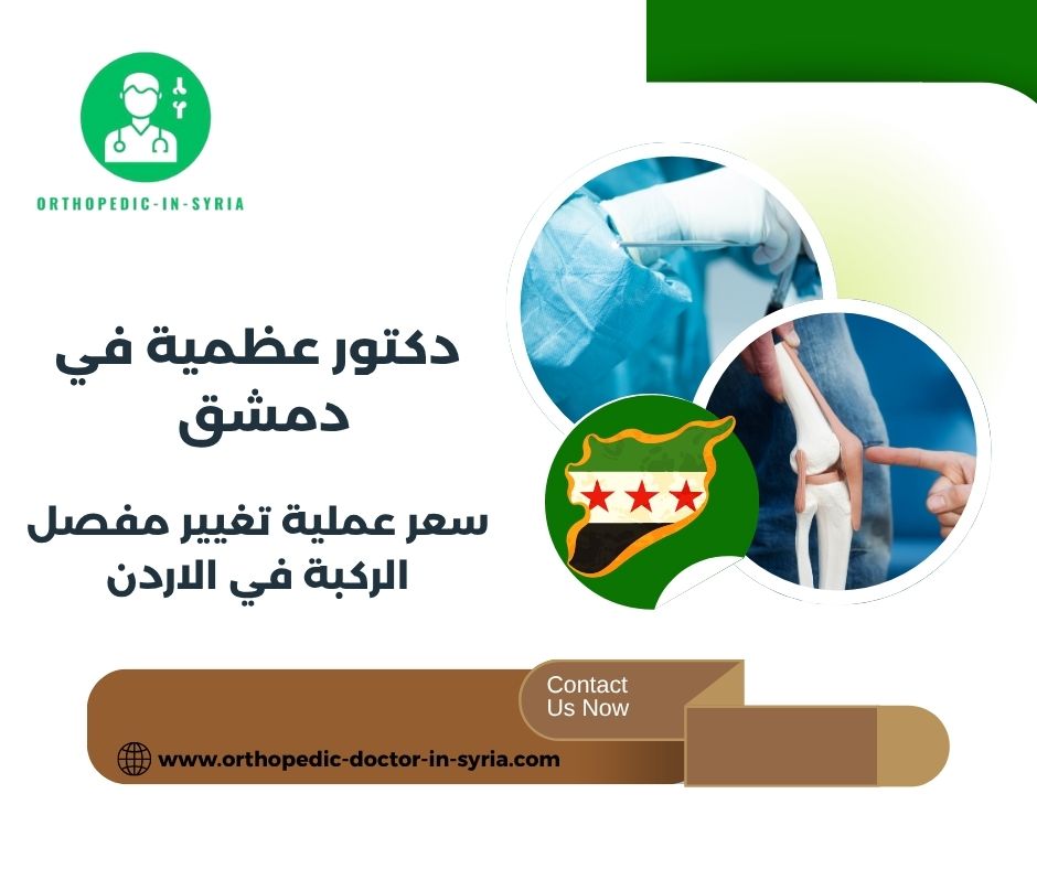 سعر عملية تغيير مفصل الركبة في دمشق سعر عملية تغيير مفصل الركبة في دمشق