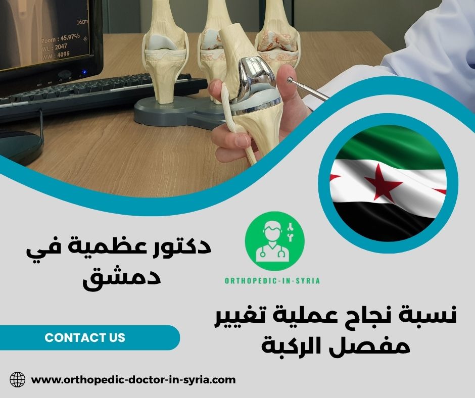 نسبة نجاح عملية تغيير مفصل الركبة