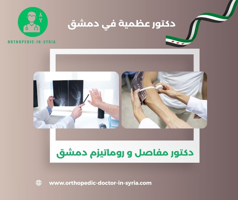 دكتور مفاصل و روماتيزم دمشق