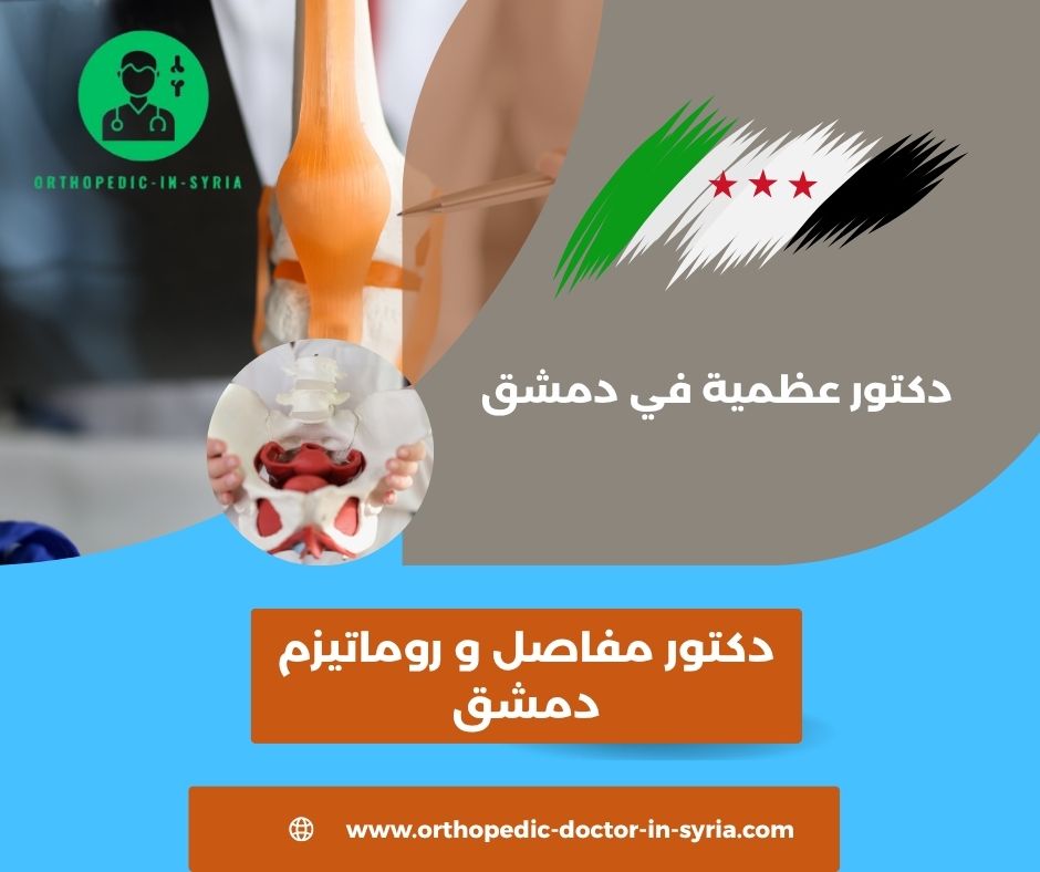 أفضل دكتور مفاصل دمشق