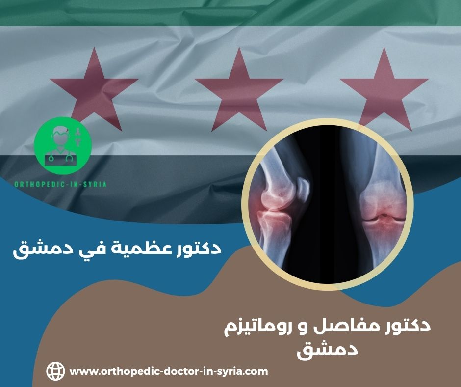افضل دكتور مفاصل في سوريا