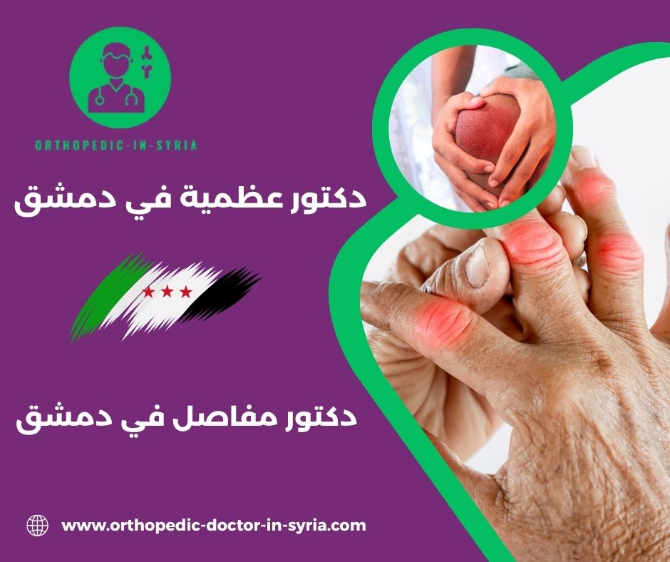 دكتور مفاصل وعظام في دمشق
