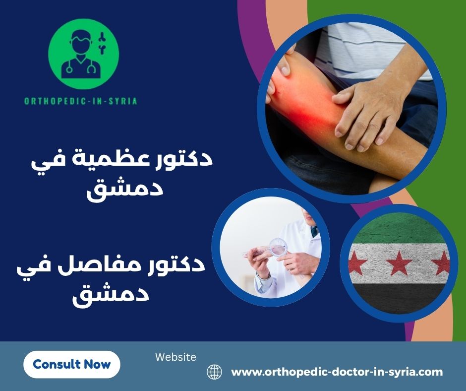 افضل دكتور مفاصل في دمشق