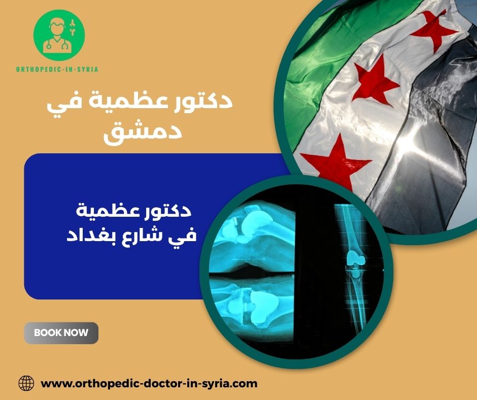 دكتور عظمية في دمشق الجسر الابيض دكتور عظمية في دمشق الجسر الابيض