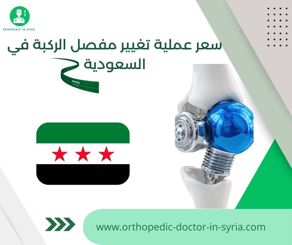 سعر عملية تغيير مفصل الركبة في السعودية