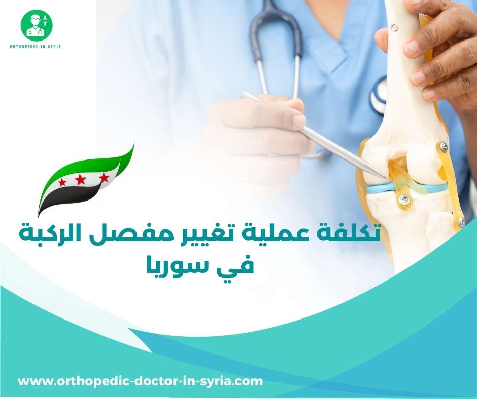 تكلفة عملية تغيير مفصل الركبة في سوريا
