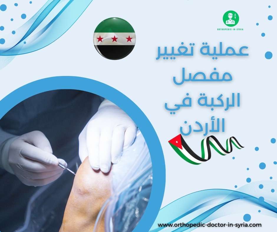 عملية تغيير مفصل الركبة في الأردن