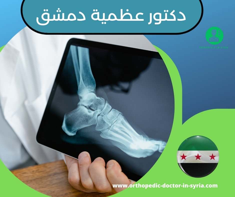 دكتور جراحة عظمية في دمشق