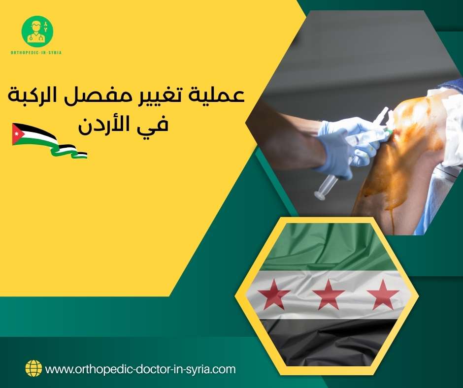 عملية تغيير مفصل الركبة في الأردن