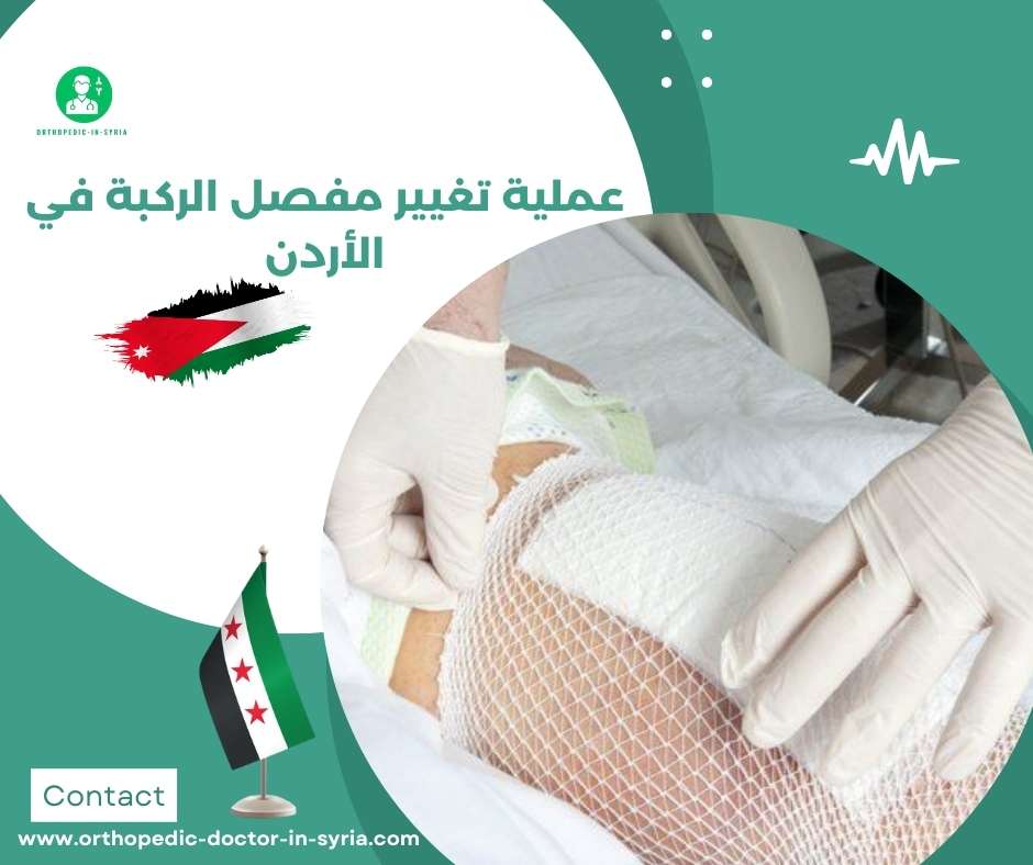 عملية تغيير مفصل الركبة في الأردن