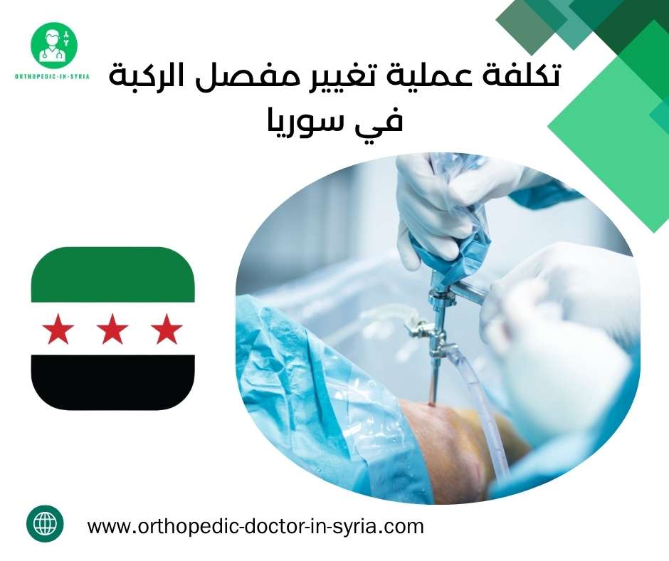 تكلفة عملية تغيير مفصل الركبة في سوريا