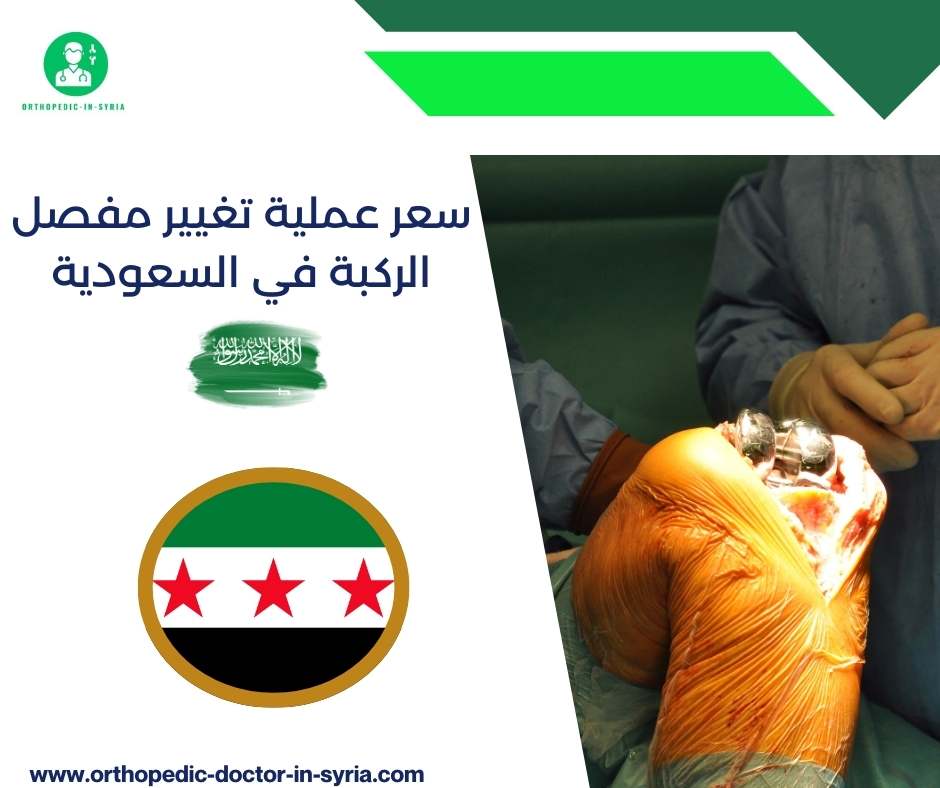 سعر عملية تغيير مفصل الركبة في السعودية