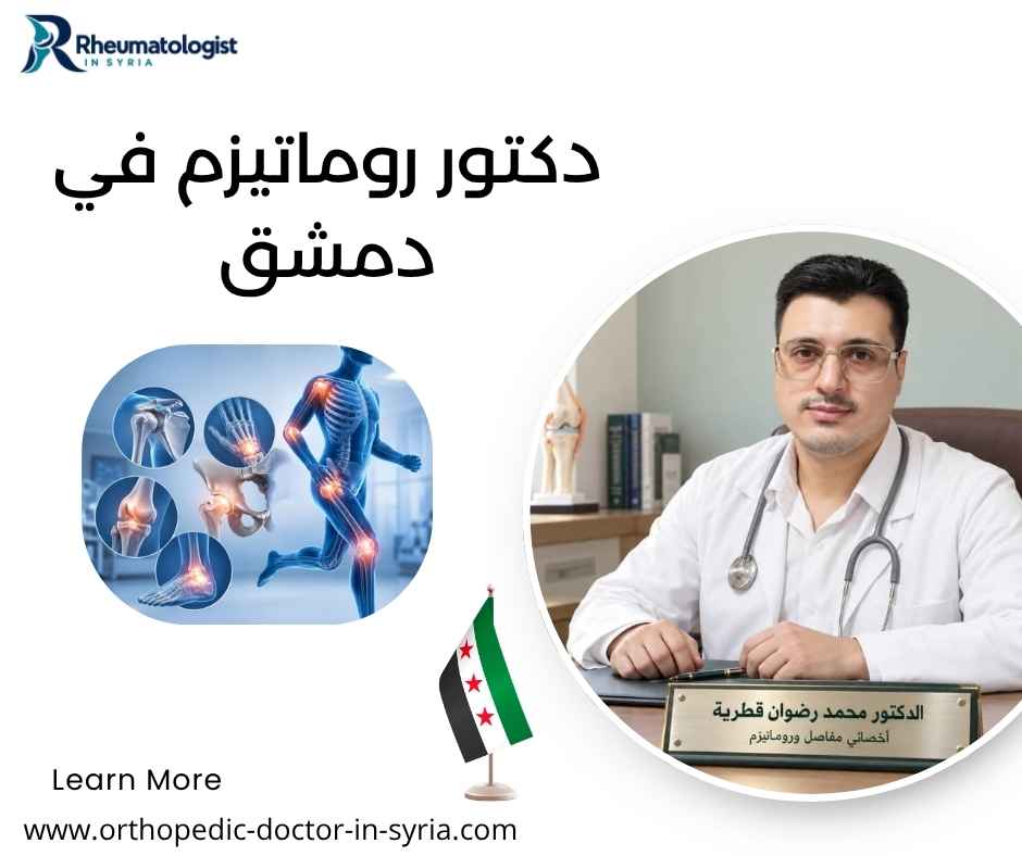 دكتور روماتيزم في دمشق