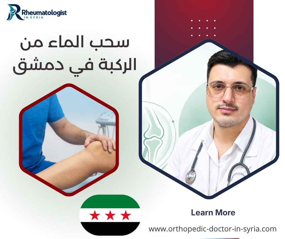 سحب الماء من الركبة في دمشق سحب الماء من الركبة في دمشق