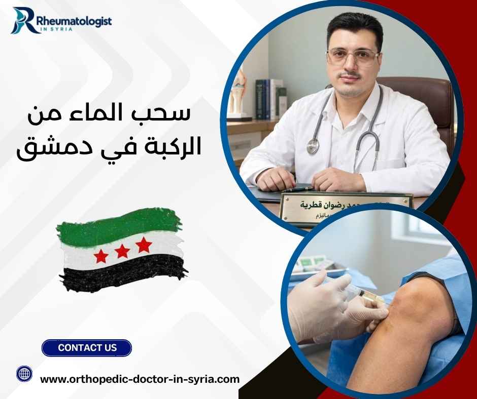 سحب الماء من الركبة في دمشق سحب الماء من الركبة في دمشق