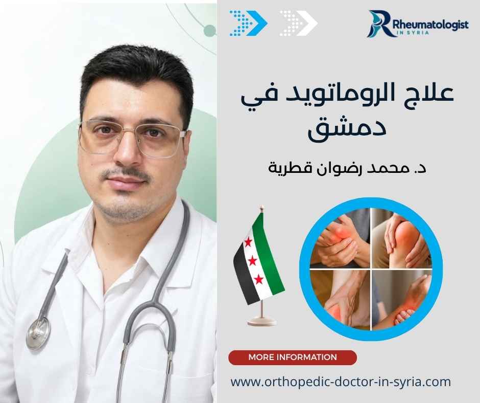 علاج الروماتويد في دمشق