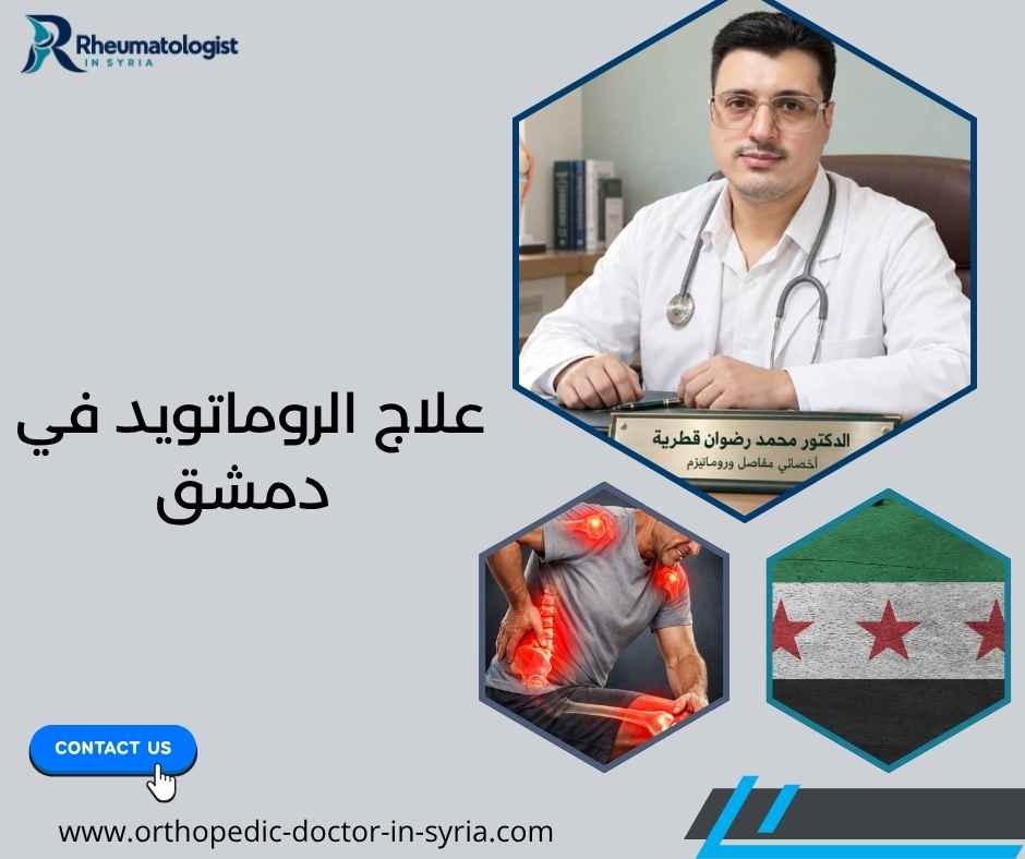 علاج الروماتويد في دمشق