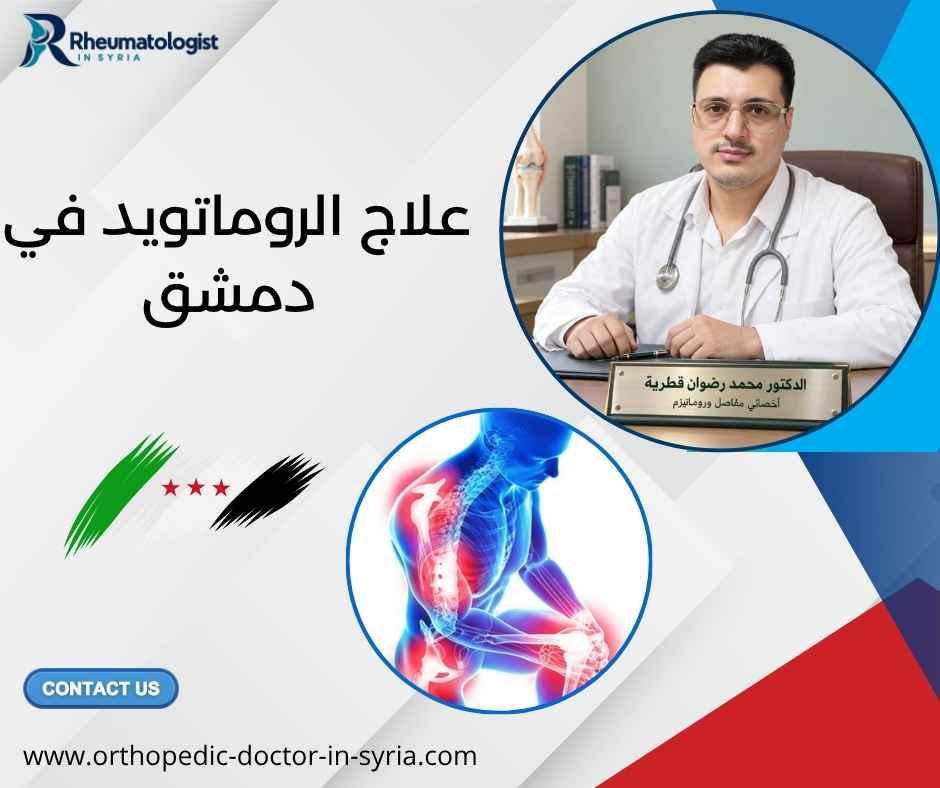 علاج الروماتويد في دمشق