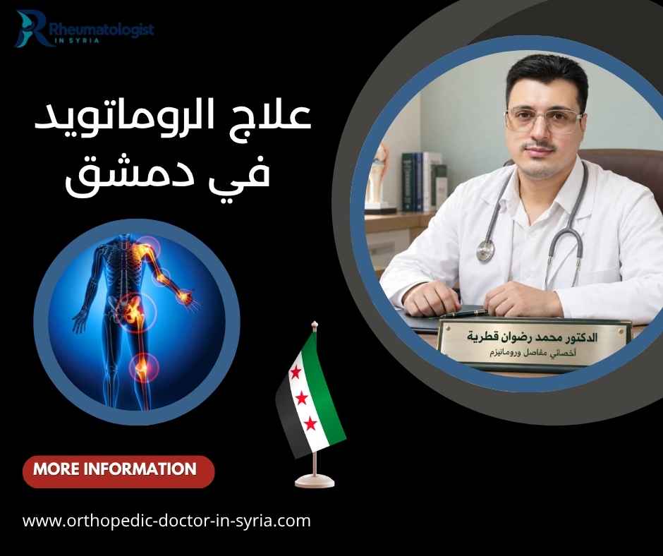 علاج الروماتويد في دمشق