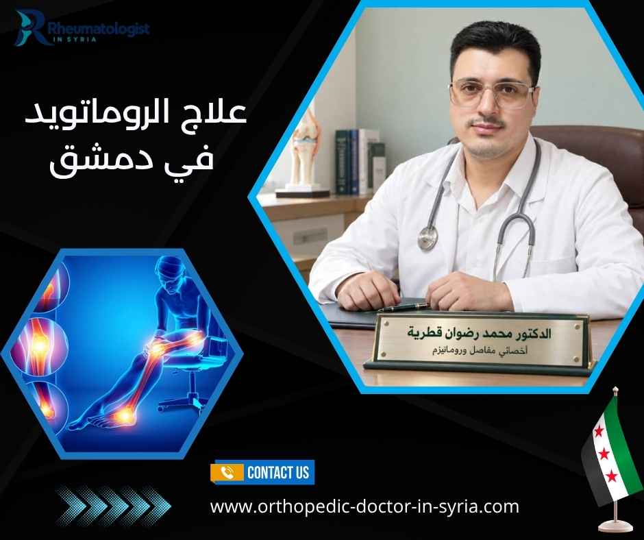 علاج الروماتويد في دمشق