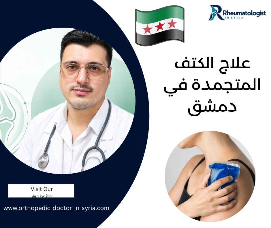 علاج الكتف المتجمدة في دمشق