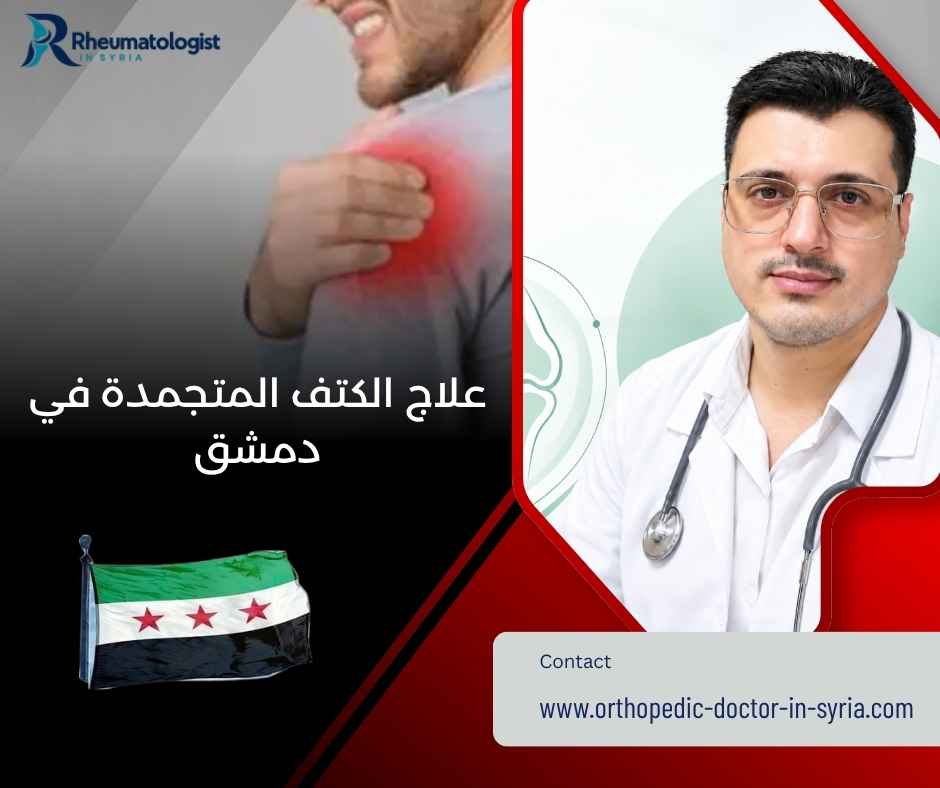 علاج الكتف المتجمدة في دمشق