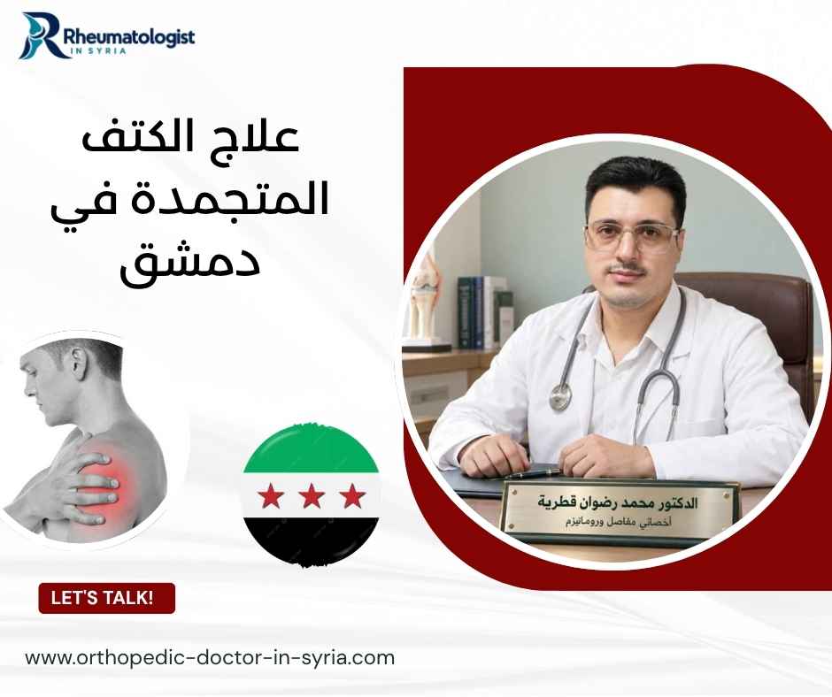 علاج الكتف المتجمدة في دمشق