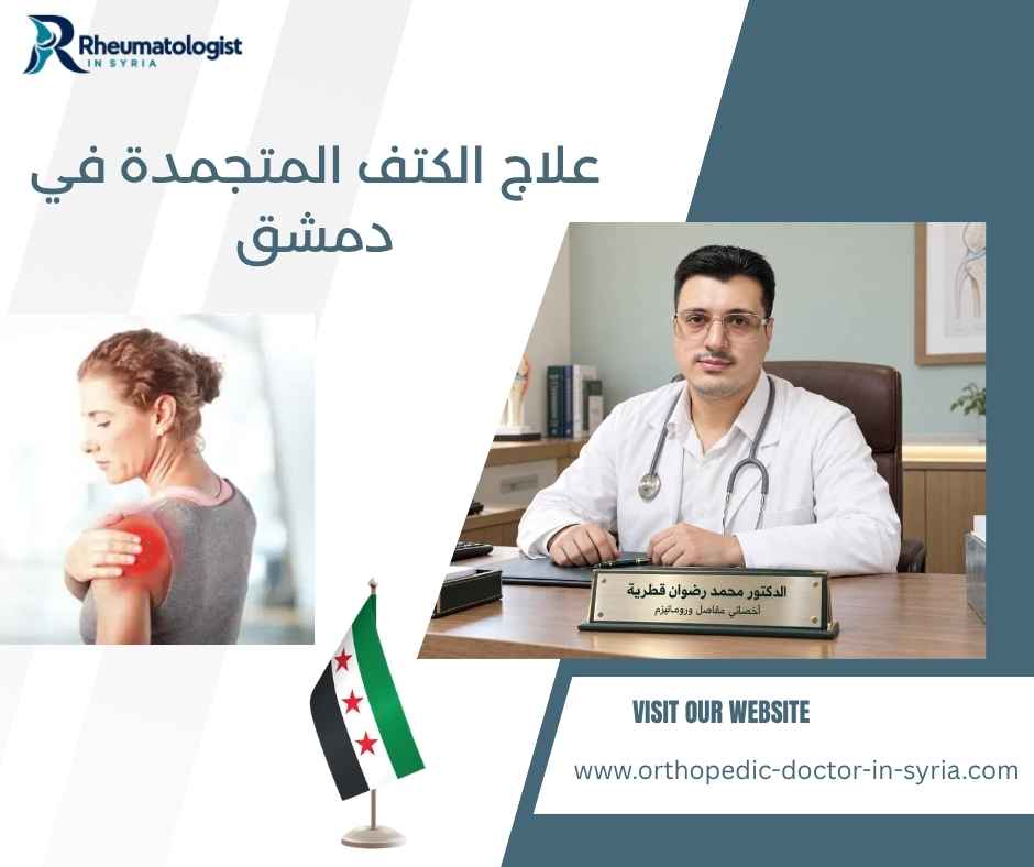 علاج الكتف المتجمدة في دمشق
