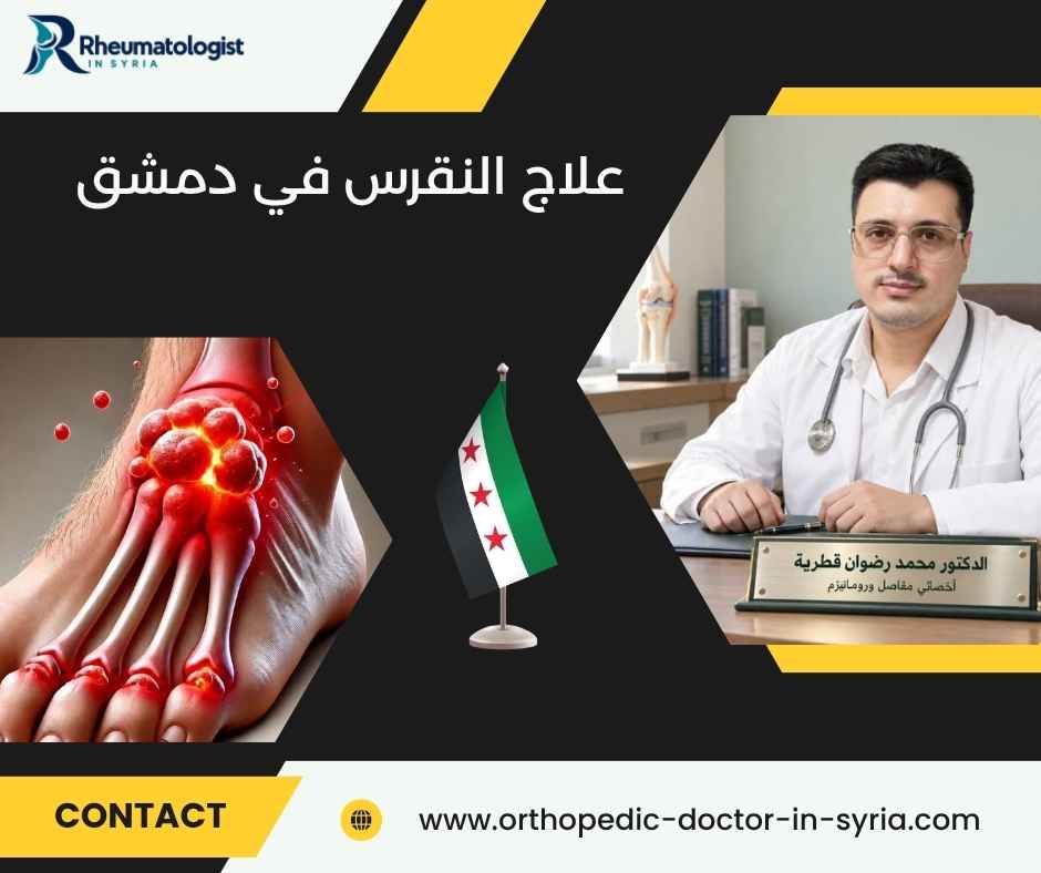 علاج النقرس في دمشق