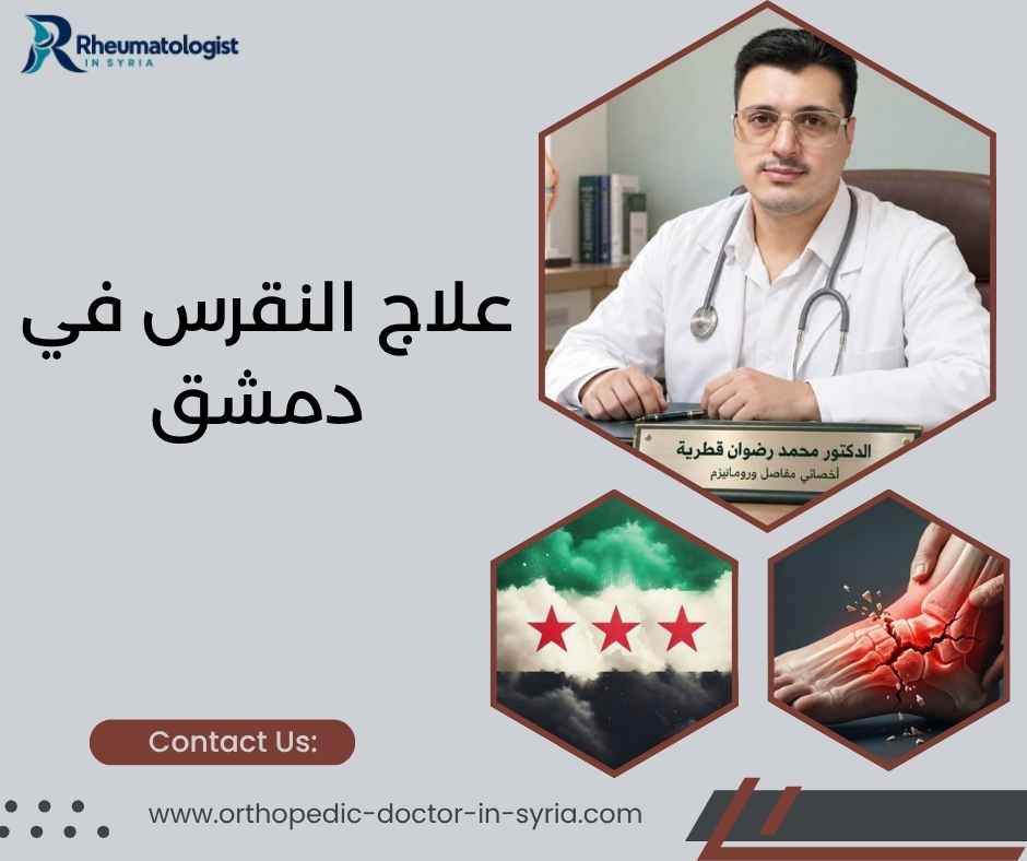 علاج النقرس في دمشق