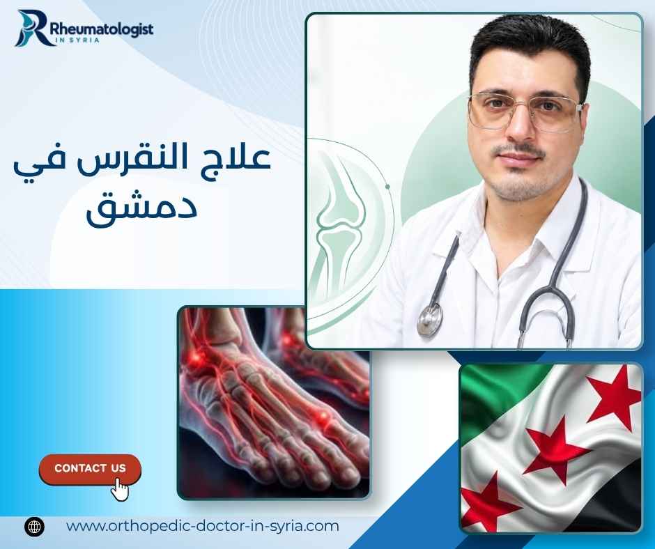 علاج النقرس في دمشق