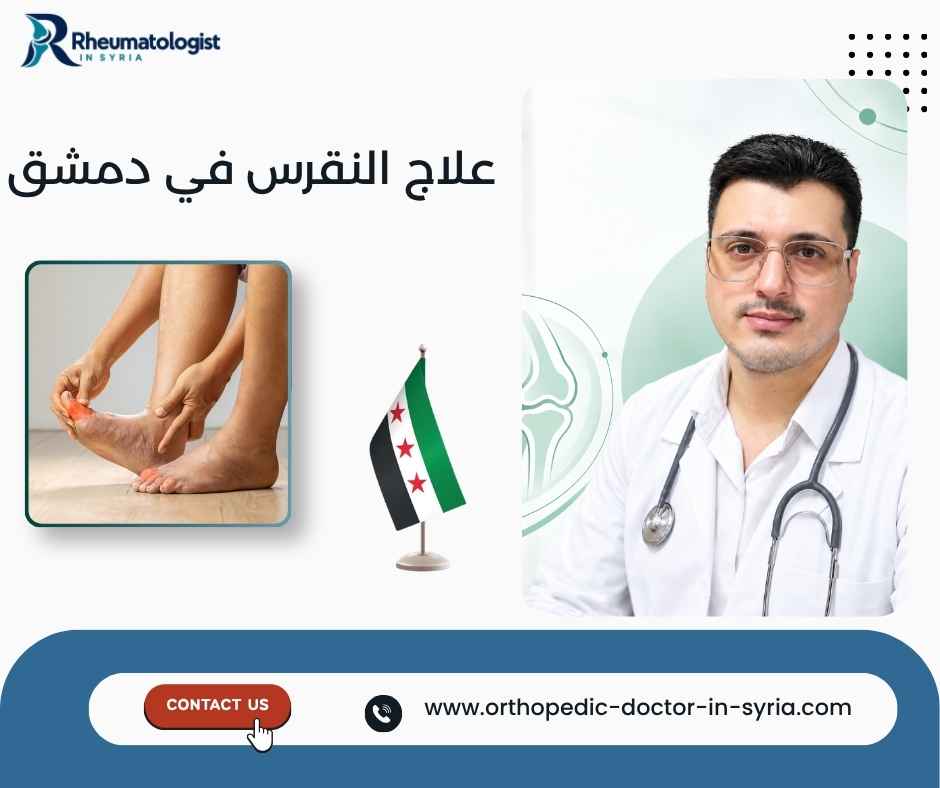 علاج النقرس في دمشق