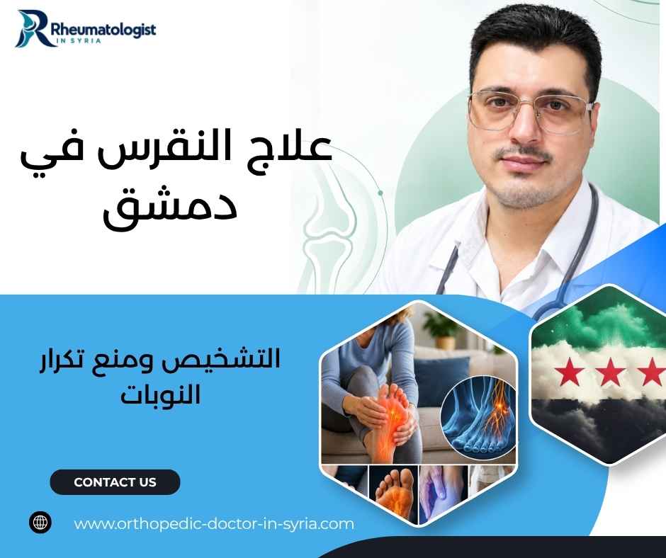 علاج النقرس في دمشق