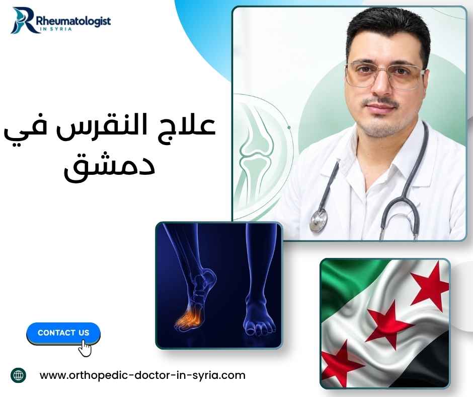 علاج النقرس في دمشق