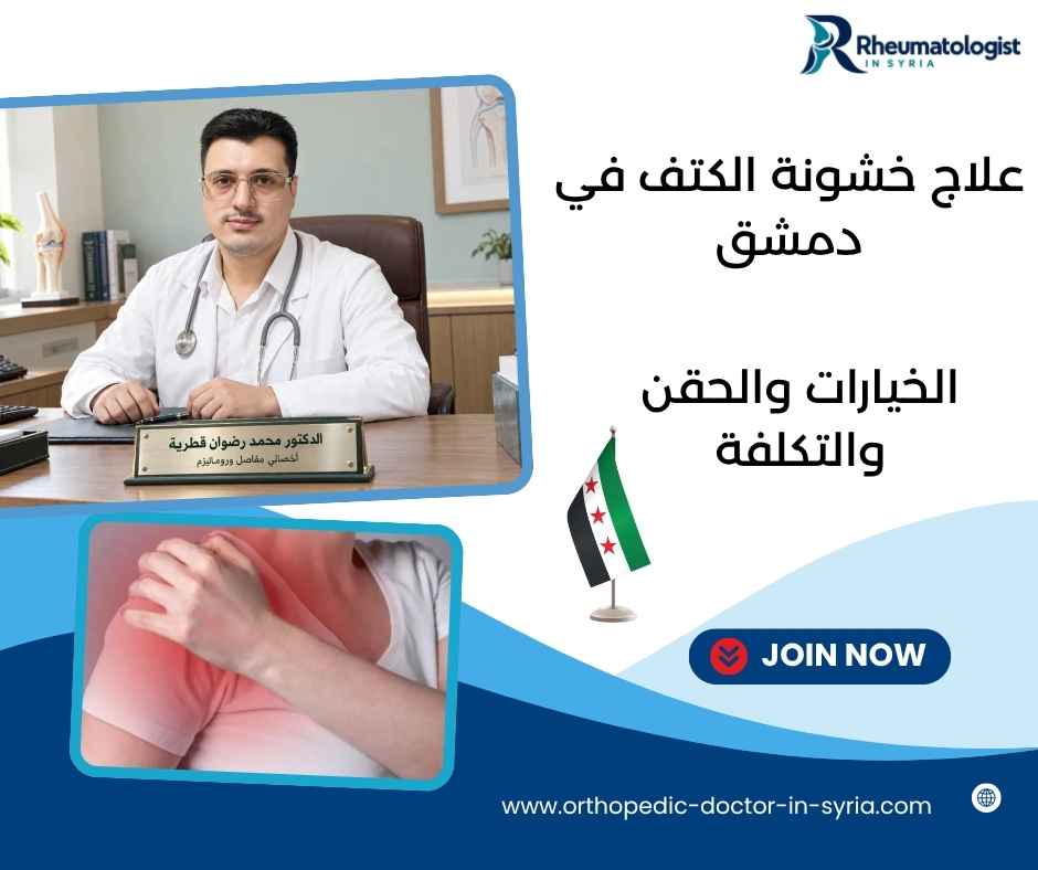 علاج خشونة الكتف في دمشق