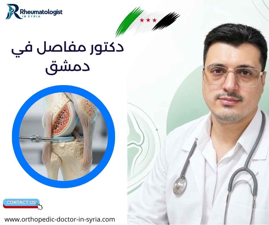 دكتور مفاصل في دمشق دكتور مفاصل في دمشق