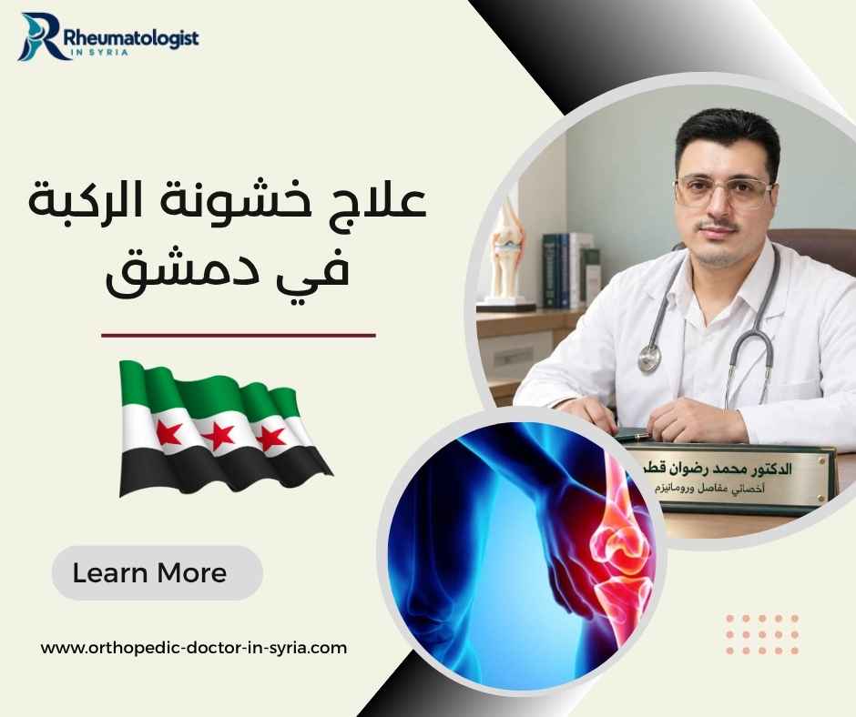 علاج خشونة الركبة في دمشق