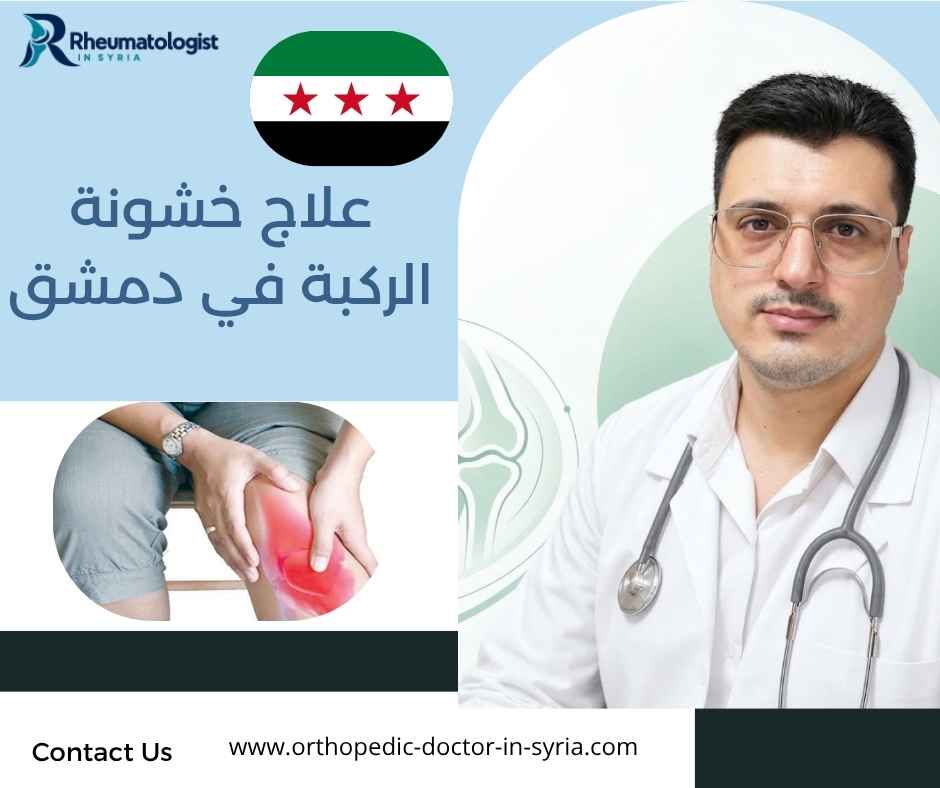 علاج خشونة الركبة في دمشق