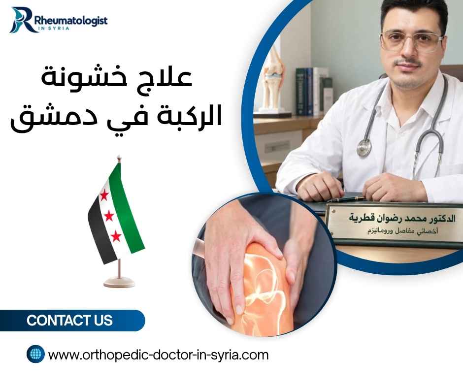 علاج خشونة الركبة في دمشق