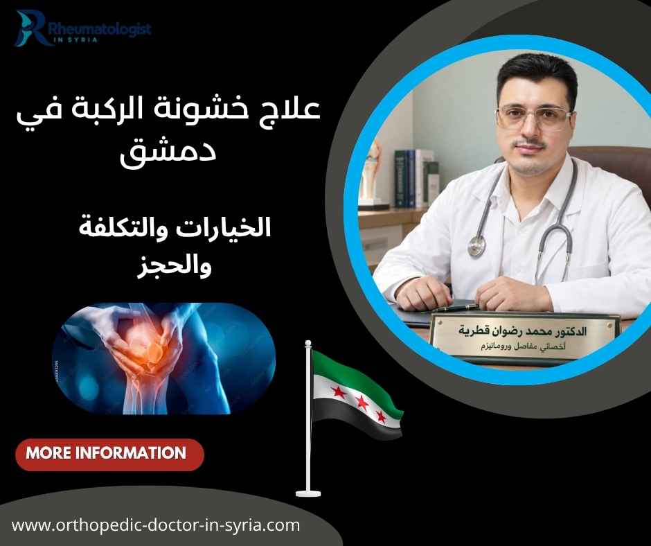 علاج خشونة الركبة في دمشق