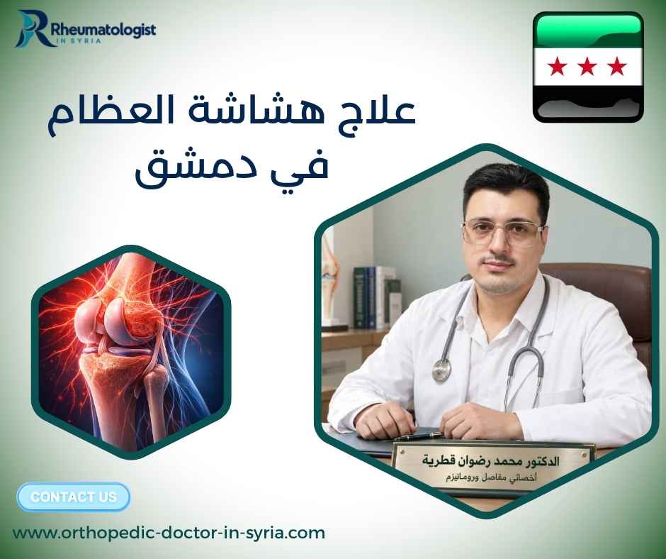 علاج هشاشة العظام في دمشق