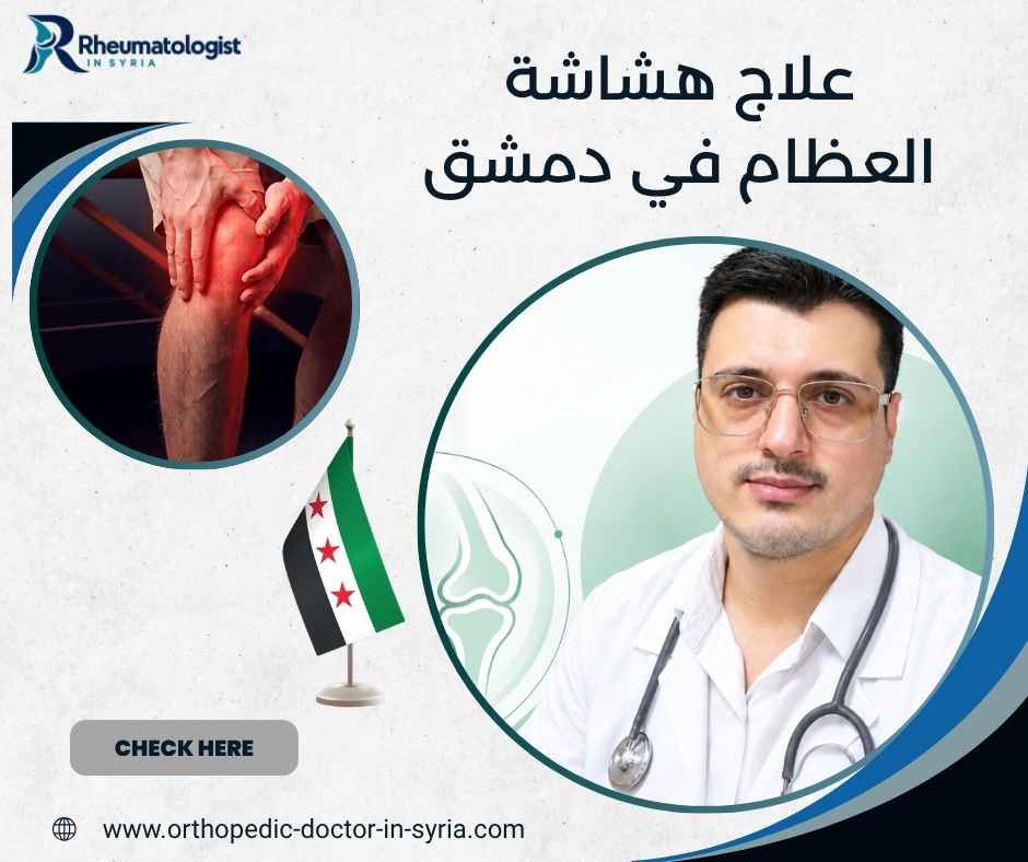 علاج هشاشة العظام في دمشق