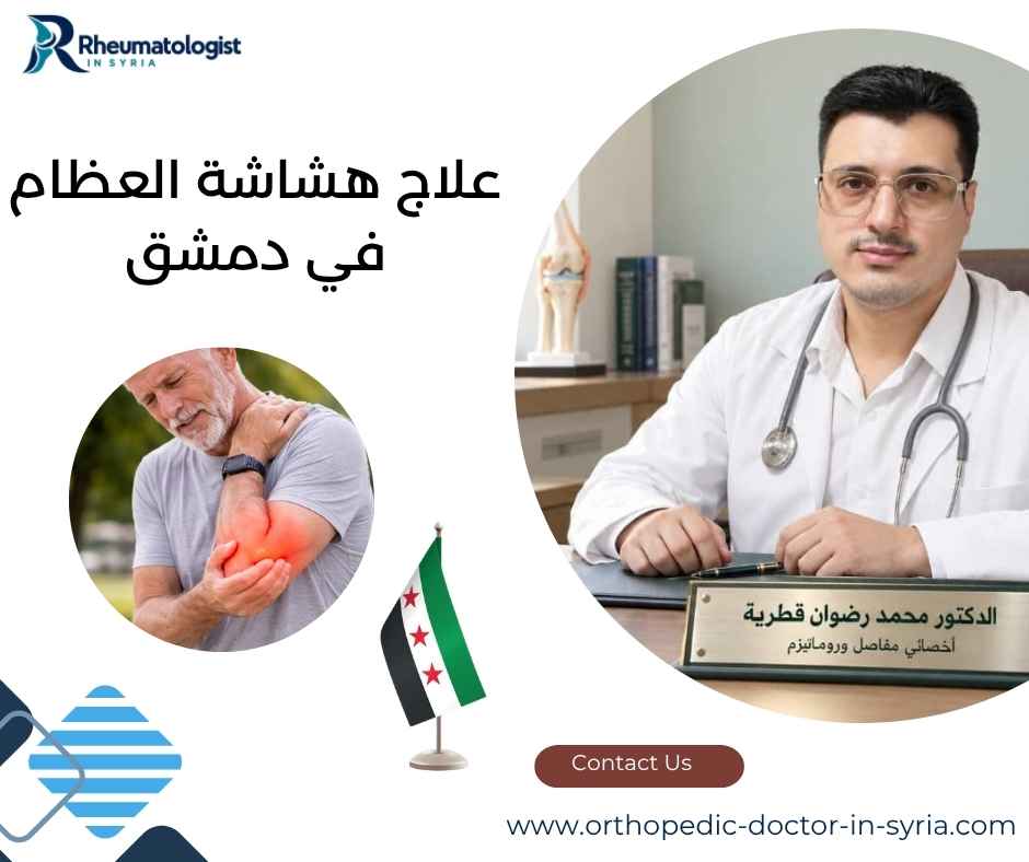 علاج هشاشة العظام في دمشق